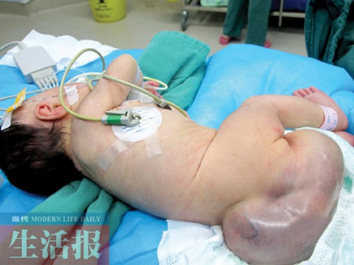 �Թ�ŮӤ�β��������������ơ��Դ����������ϣ�ͼ��